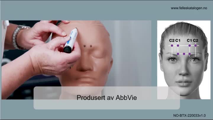 Instruksjonsfilm for administrering av Botox ved migrene.