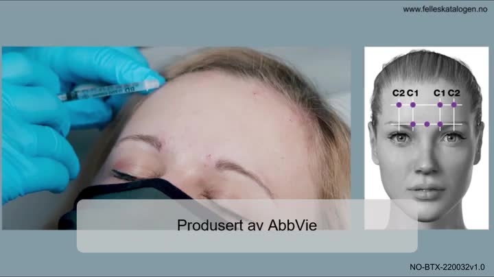 Instruksjonsfilm for administrering av Botox ved migrene.